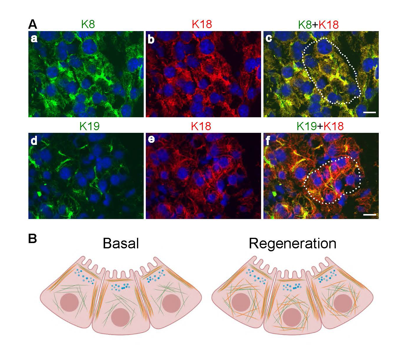 Intermediate Filament Keratins In The Exocrine Pancreas Pancreapedia